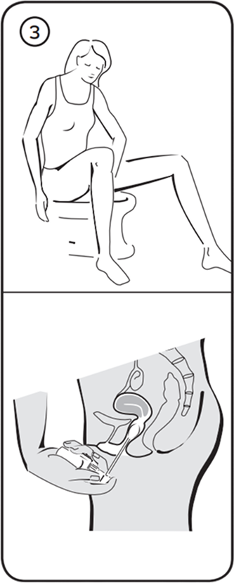 3. lépés: alkalmazás